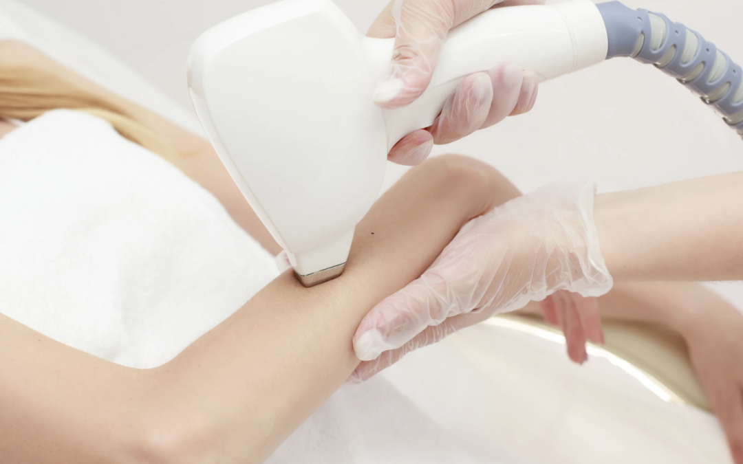 Best Laser Hair Removal Services in Potomac, MD